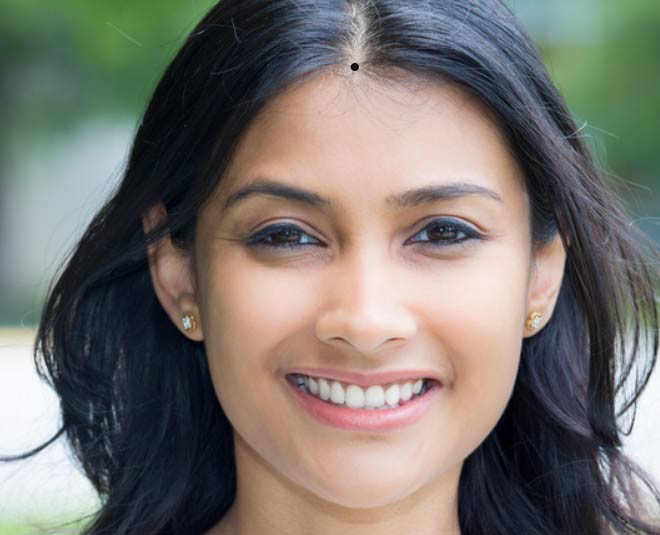 moles  on  female forehead