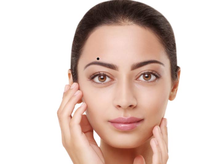 moles  on  forehead results