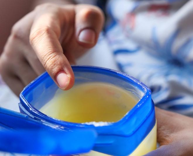 remedies for curing cracked heels