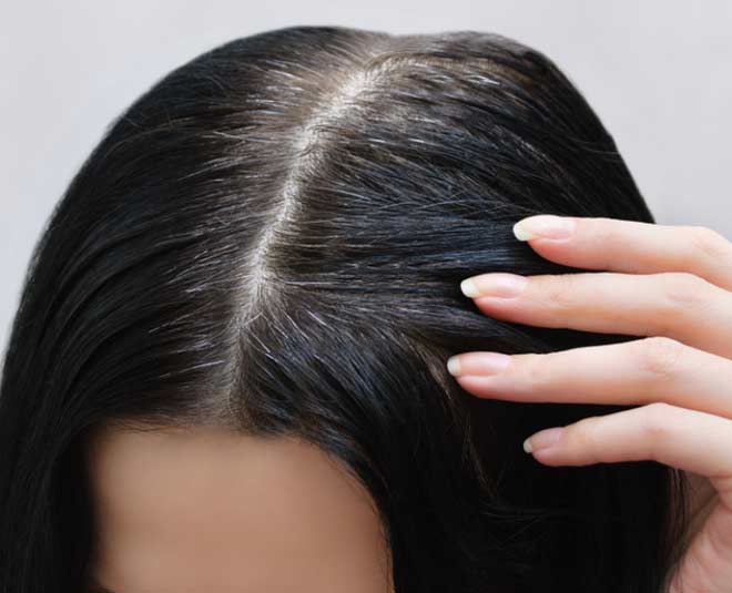stop  grey  hair  naturally