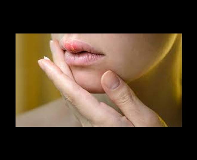 सूजन को दूर करती है uses of aspirin tablets for lips