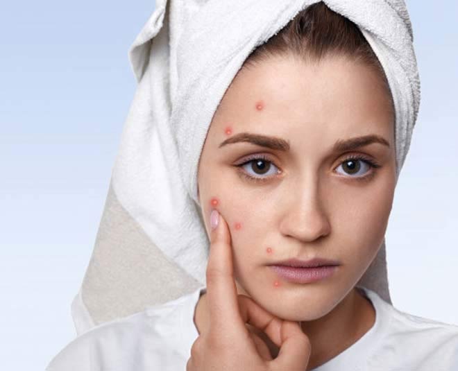 त्वचा के दाग-धब्बों को दूर करती है uses of aspirin tablets for skin