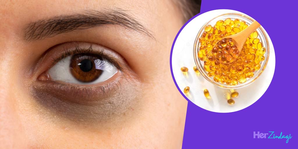 How to Use Vitamin e Oil for Dark Circles विटामिनई के छोटे से कैप्