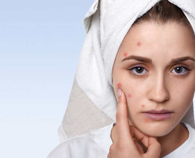 applye face pack for oily skin