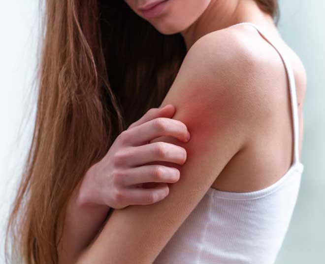 argan oil helps in skin irritation