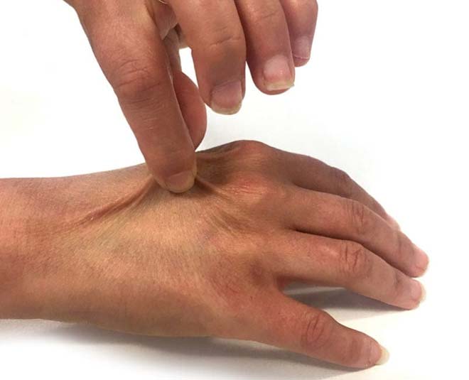 best skin and dehydration test best skin and dehydration test