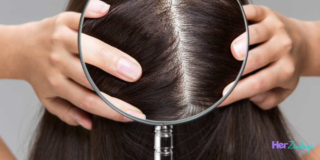 10-best-home-remedies-for-dry-scalp-and-prevention-tips