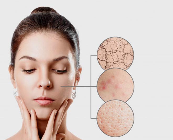 dry skin summer reason