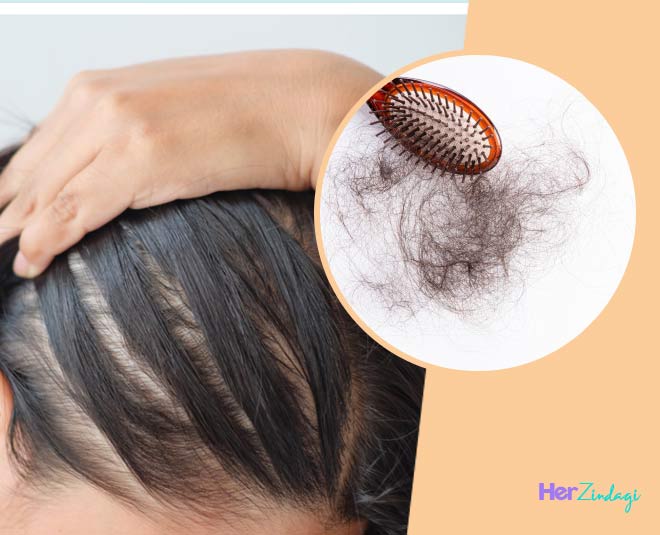 Here's The Difference Between Hair Fall And Hair Thinning | HerZindagi