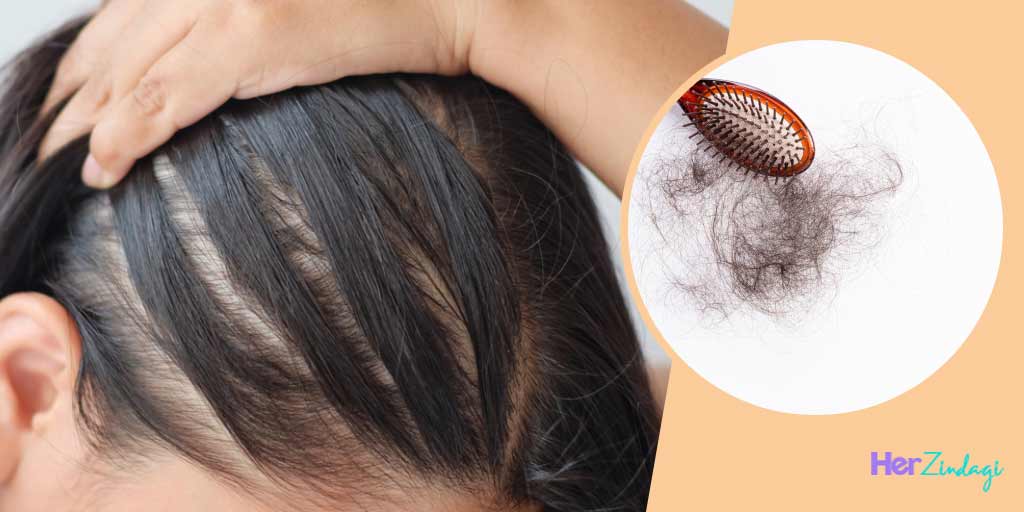 Here's The Difference Between Hair Fall And Hair Thinning | HerZindagi