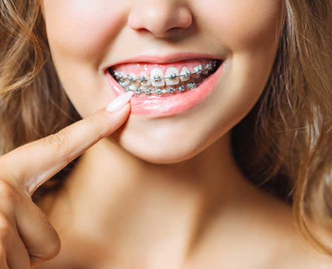 how to take care of dental braces inside 