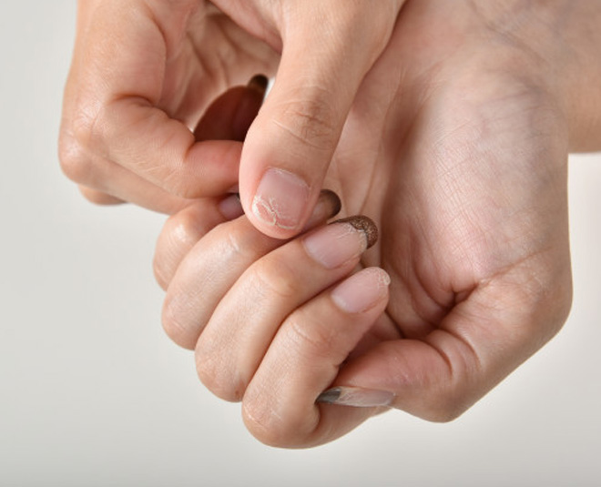 lemon  seeds  for nail fungus