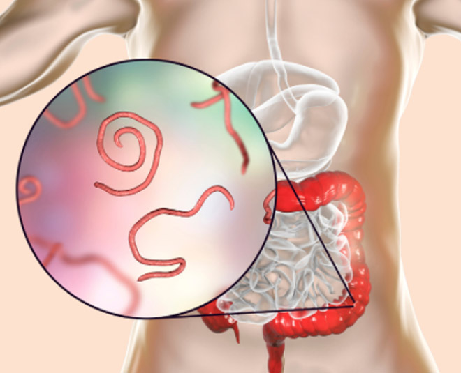 lemon  seeds  for treadworm