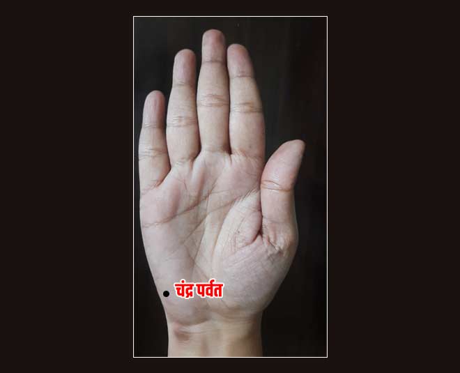 moles  on  palm rejust