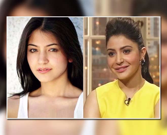 Before And After Pictures Of Bollywood Actresses Who Opted For Plastic