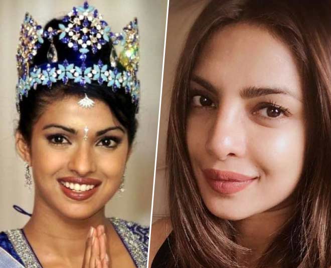 Before And After Pictures Of Bollywood Actresses Who Opted For Plastic  Surgery | HerZindagi