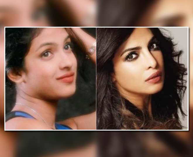 plastic-surgery-priyanka.jpg