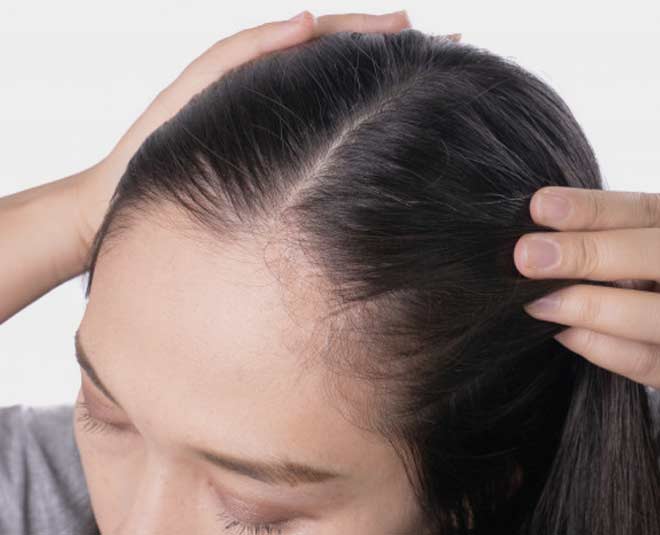 how-to-get-rid-of-sticky-scalp-during-humid-weather-how-to-get-rid-of