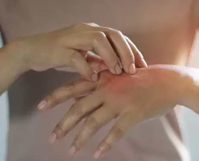 skin boils and infection