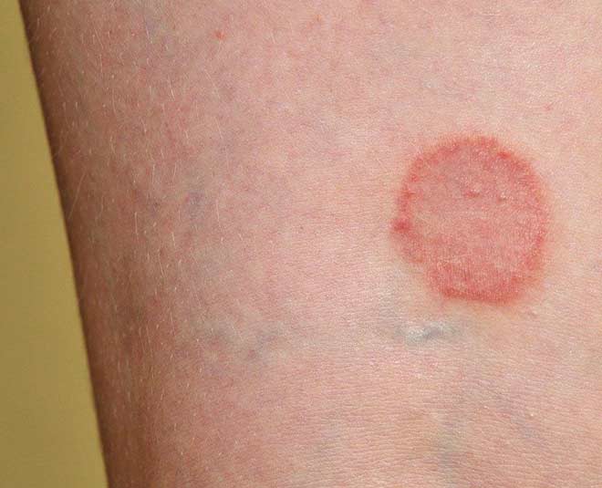 skin dark hard reactions for diabetes