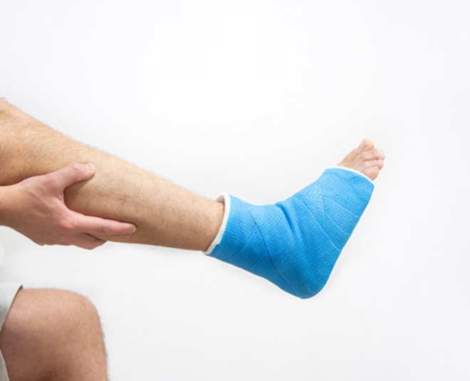 sprain treatments www.worldcreativities.com