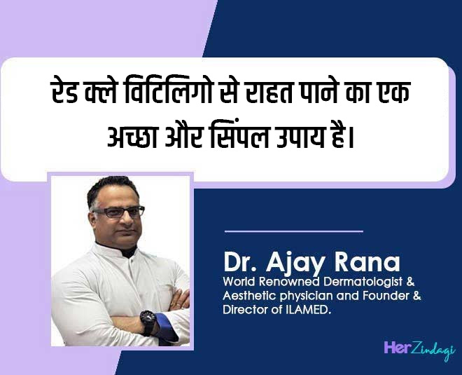 vitiligo treatment coconut inside  ()