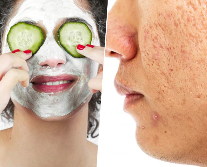 How do you treat skin pigmentation