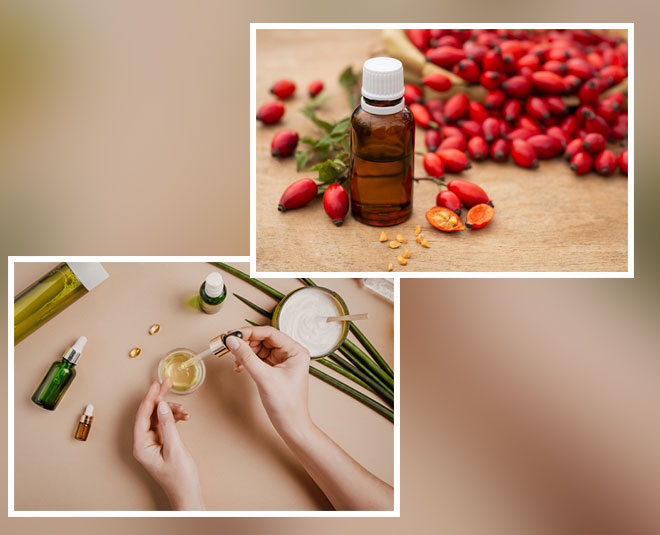 Rosehip oil