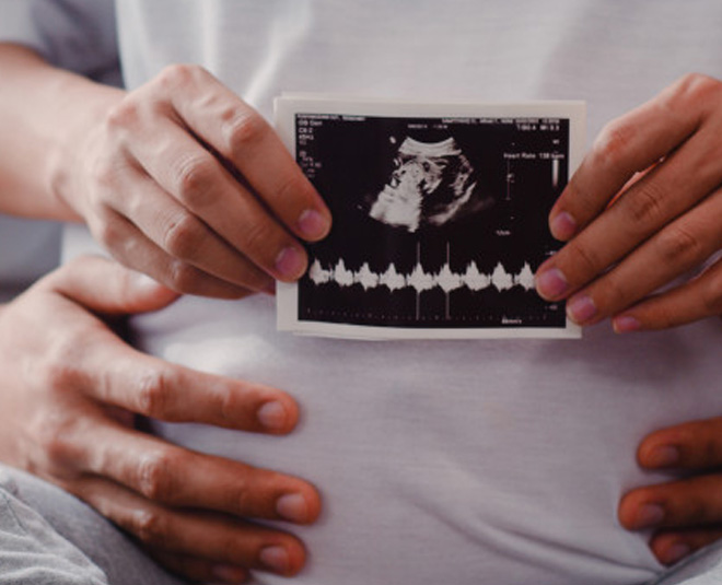 Who Are At A Higher Risk Of Producing Babies With Down’s Syndrome