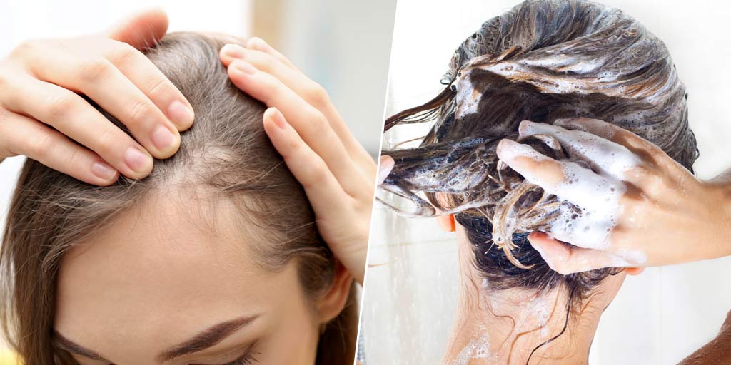 Best Shampoos For Hair Loss In India OnlineBest Shampoos For Hair Loss In India Online