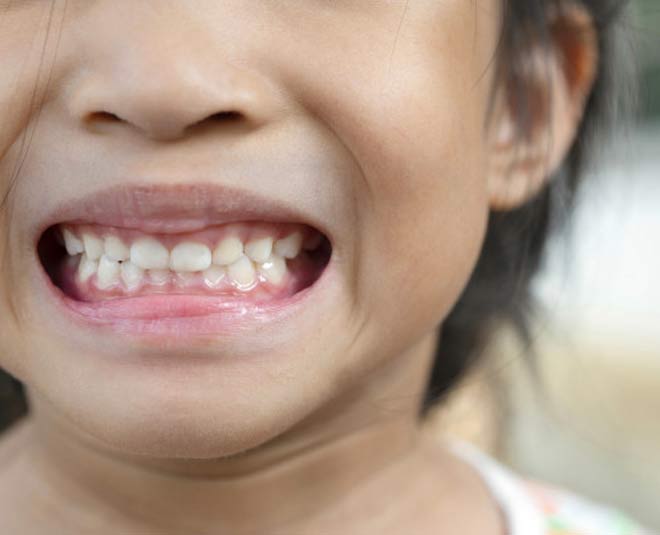 How To Remove Plaque From Teeth In Hindi how to remove plaque from