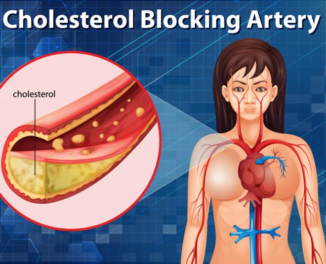 cholestrol blockage