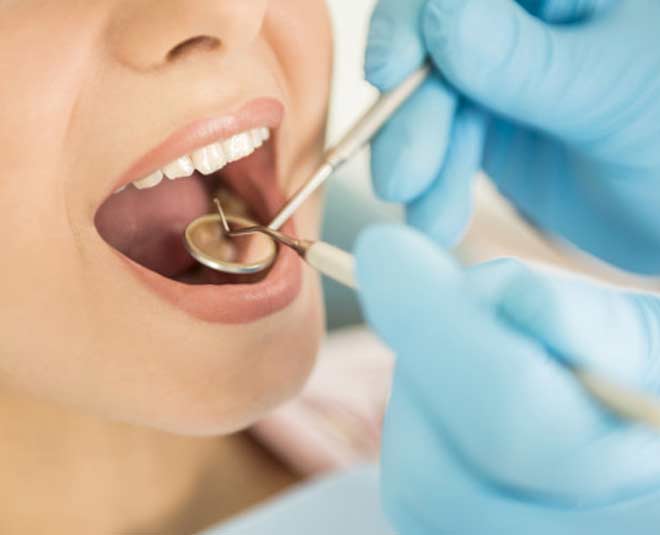 dentist advice plaque