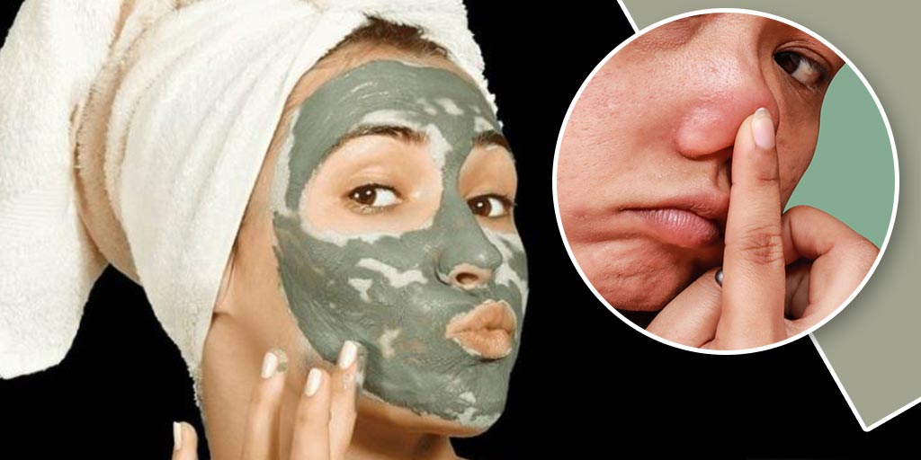 Face Masks For Acne Prone Skin, Sensitive Skin Under Rs 700 Face Masks