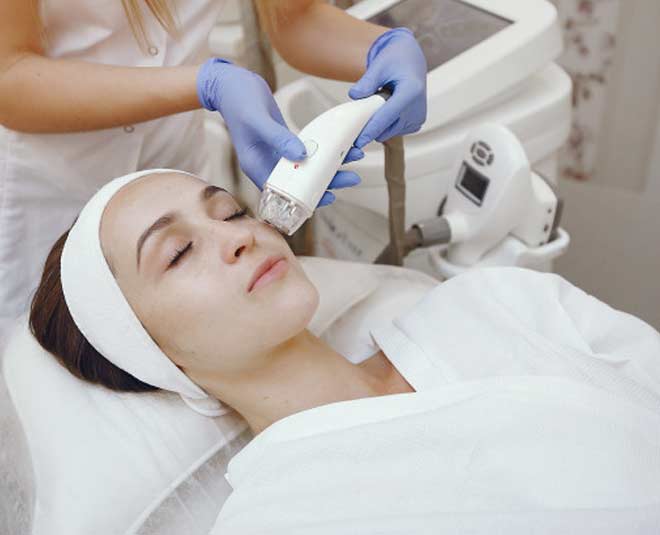 laser treatment age spots on face inside 