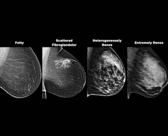 Important Gynae Checks You Must Get Done As Per Age Explains ...