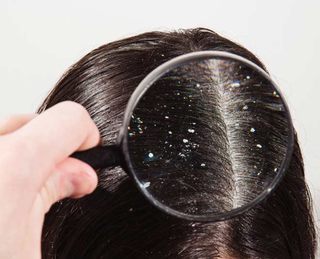 neem oil uses dandruff inside 