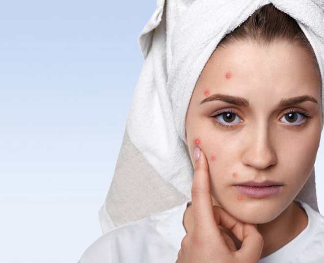 neem oil uses for acne inside 