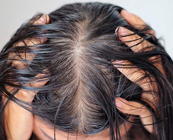 oily hair and corn starch