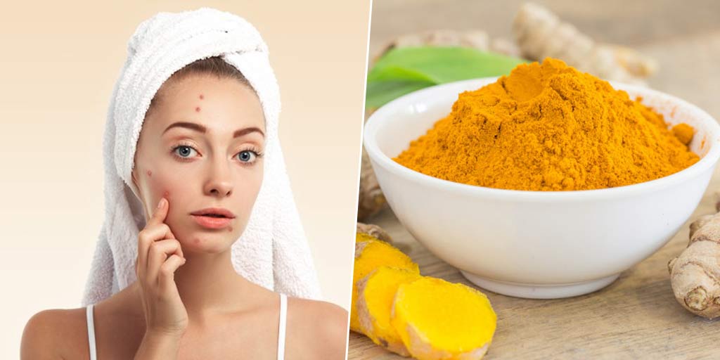 Here Is Your Guide To Use Raw Turmeric For AcneHere Is Your Guide To