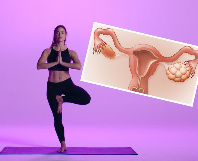 5 Yoga Asanas to Regulate Hormonal Imbalance