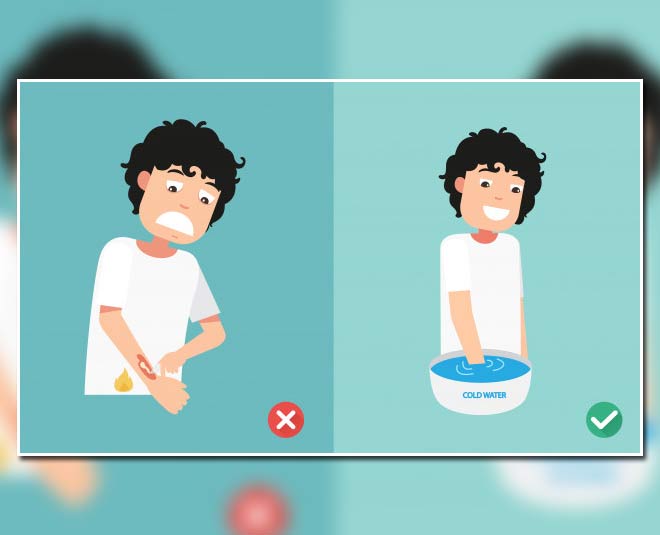 ठंडे पानी का इस्तेमाल cold water therepy