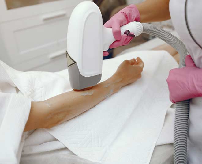 inside  lezer hair removel myths 