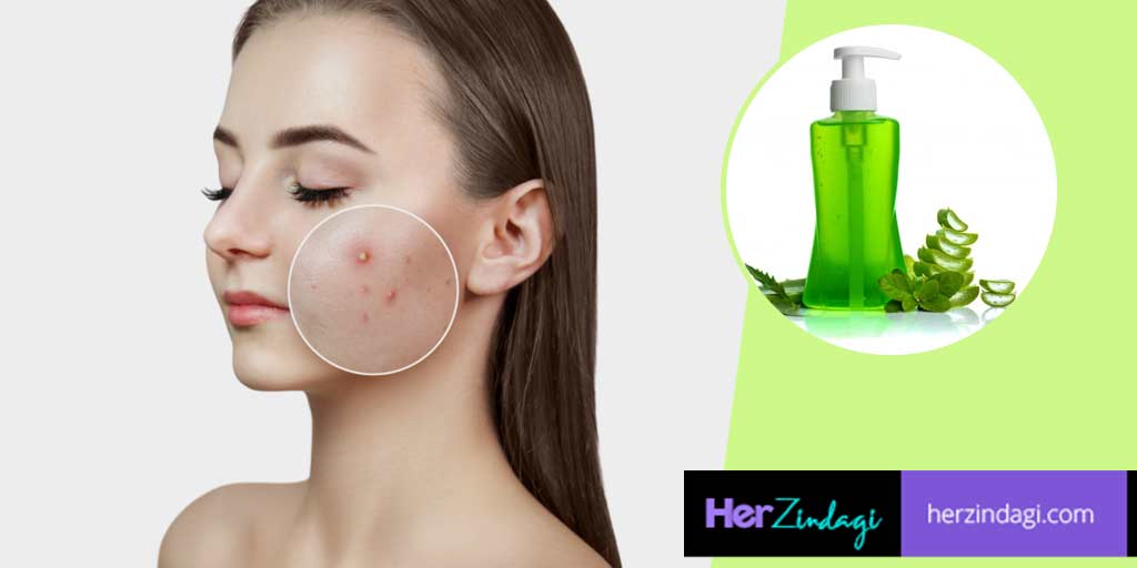 Neem Facial Gel For Acne At Home