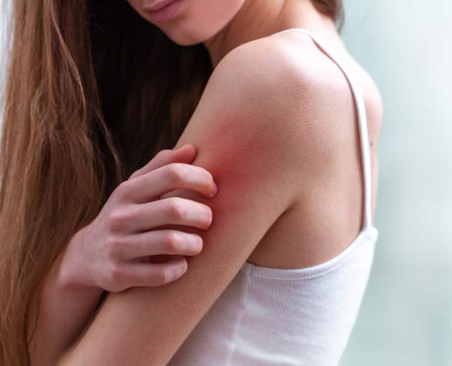 neem oil uses for ezema inside 