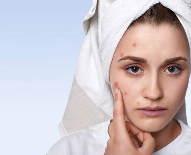 neem oil uses pimples inside 