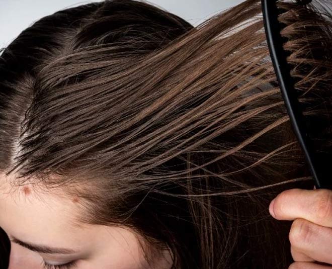 have-oily-hair-in-summer-try-these-10-effective-home-remedies-herzindagi