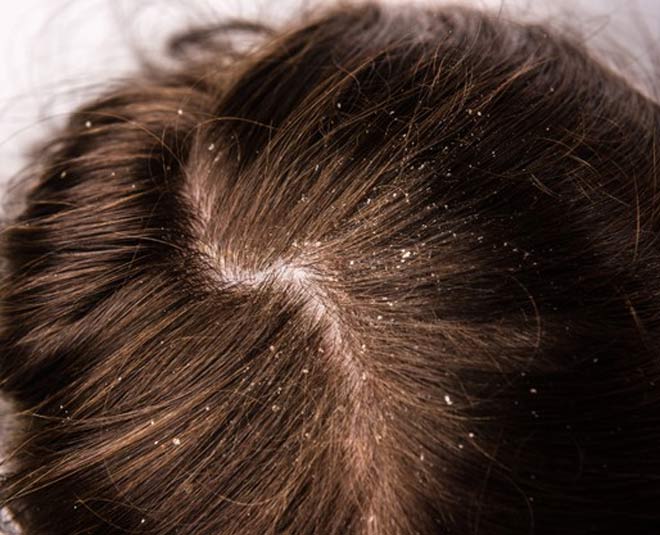 uses of hibiscus flower for hair inside
www.worldcreativities.com