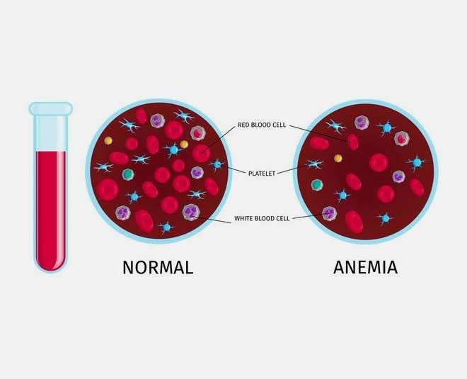 anemia and infections