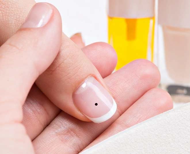 WorldCancerDay: Never ignore this one sign on your nail - Times of India